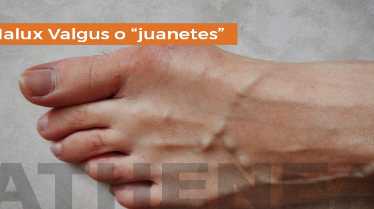 JUANETES BLOG