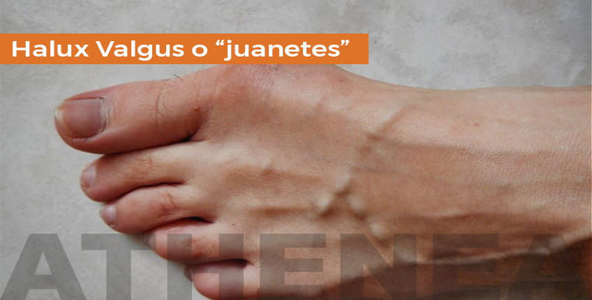 JUANETES BLOG